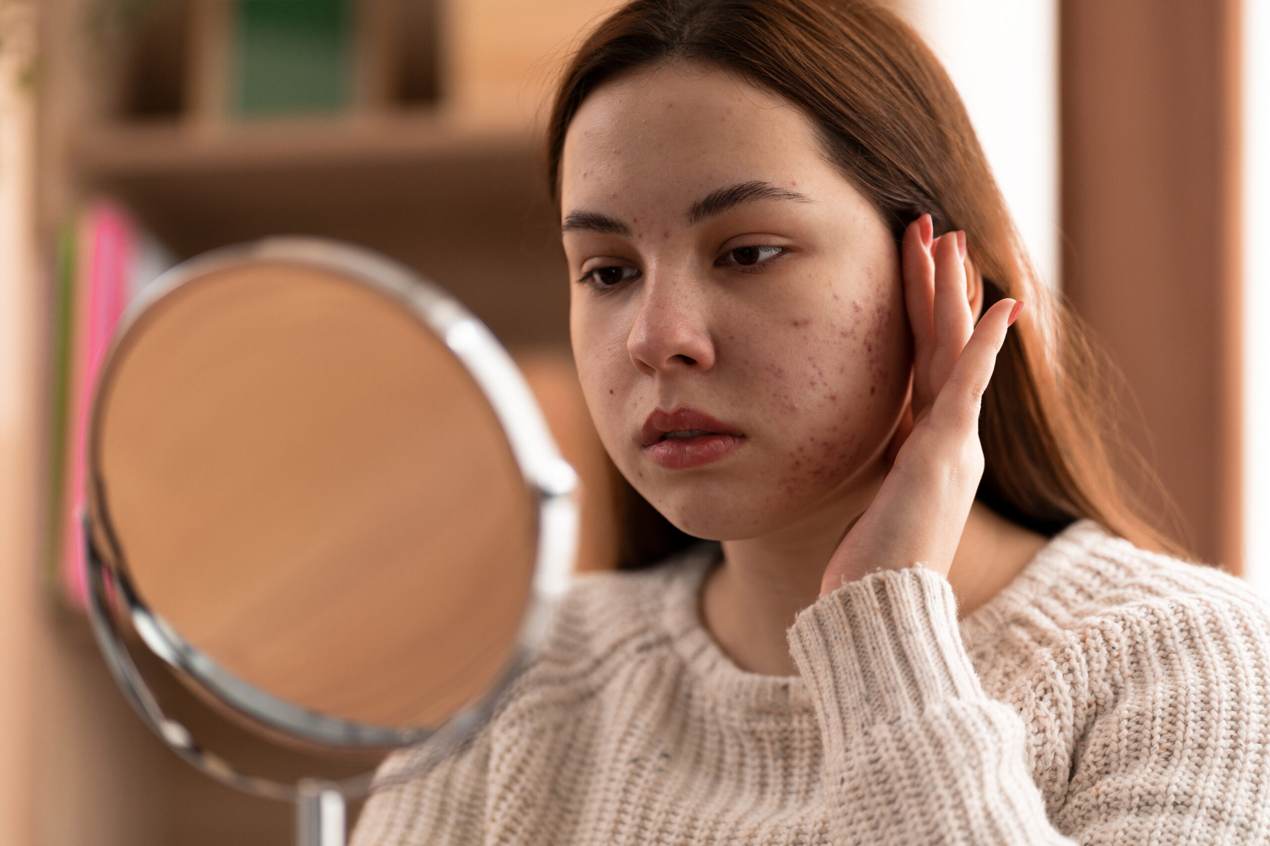 Skin Problem